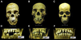 Three African Individuals from the San José de los Naturales Royal Hospital