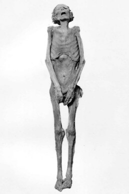 “Unknown Man E” believed to be Pentawer, Ramesses III’s eldest son who participated in the “harem conspiracy” to overthrow his father and put himself on the throne.