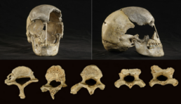 A genome sequence from a modern human skull over 45,000 years old from Zlatý kůň in Czechia